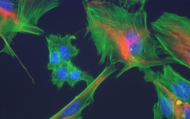 cell 1